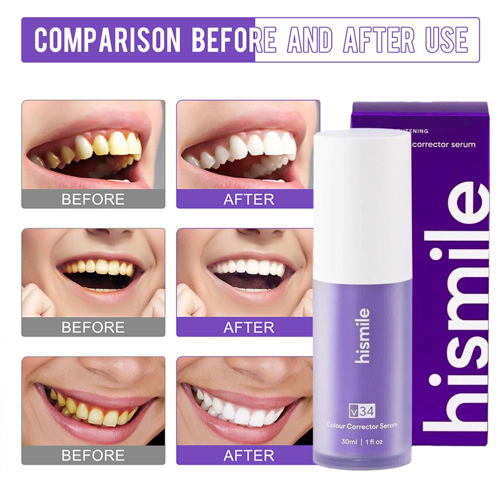Teeth Whitening Crest - 30 мл Hismile V34 Фиолетовая пена