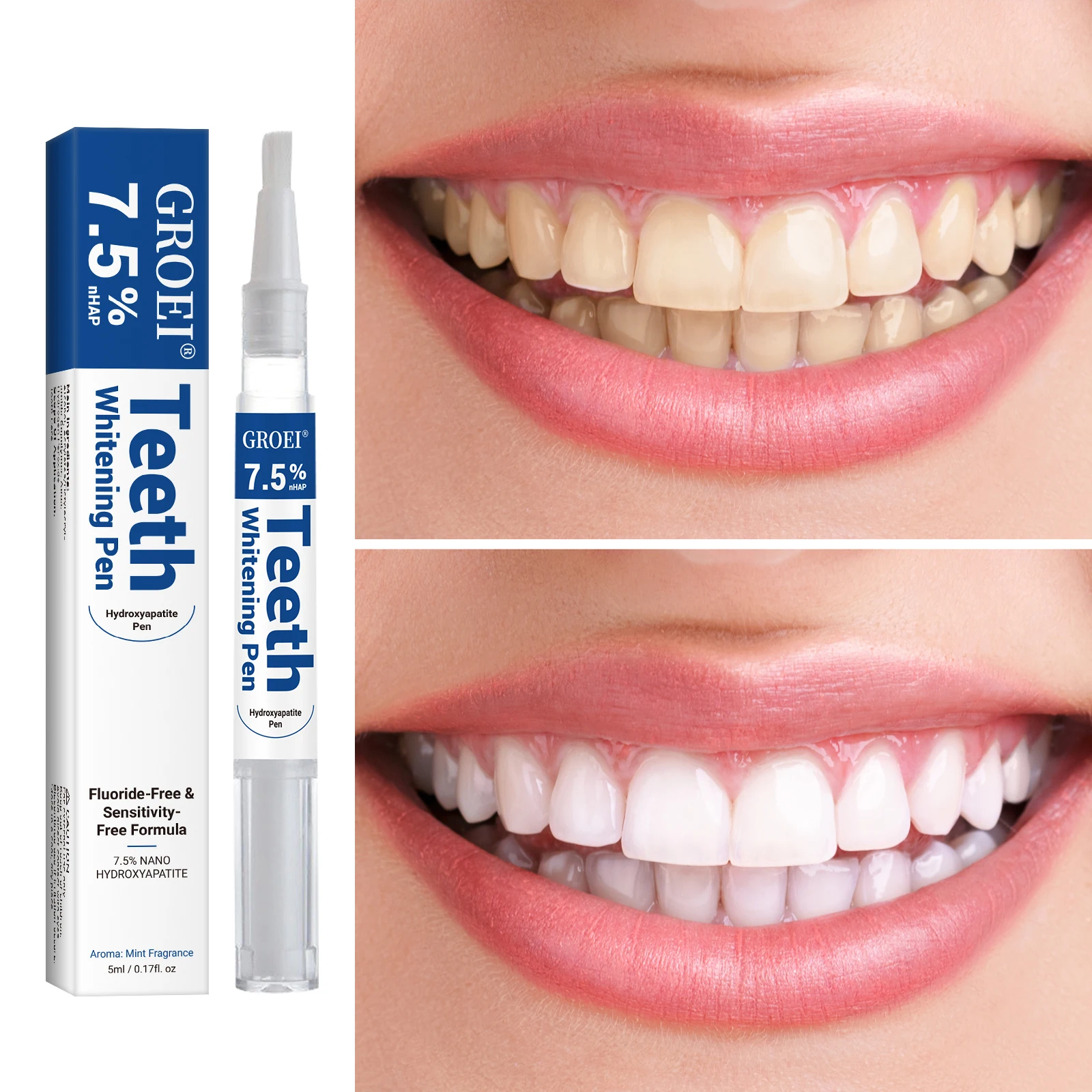 Гидроксипатитовая ручка для от – обзор и цена Teeth Whitening Gel