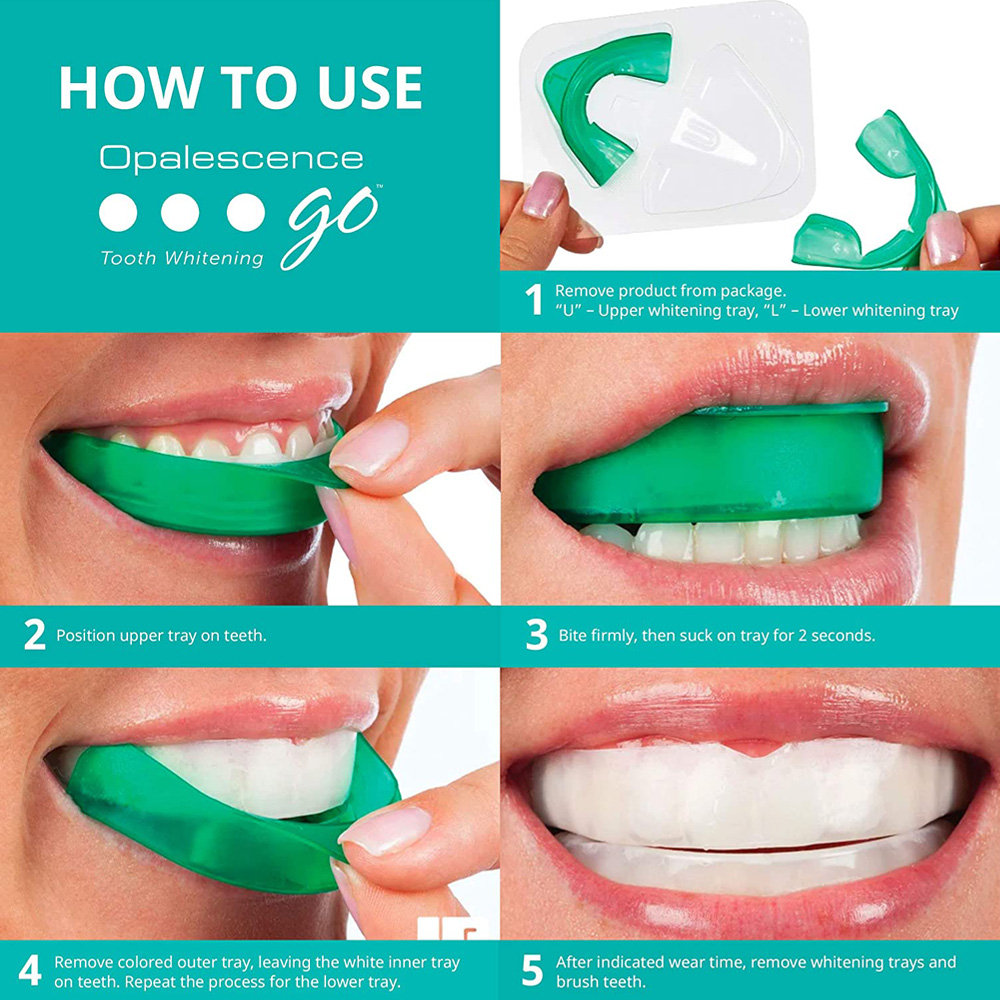 Пероксид водорода для отбелива – обзор и цена Teeth Whitening With Trays