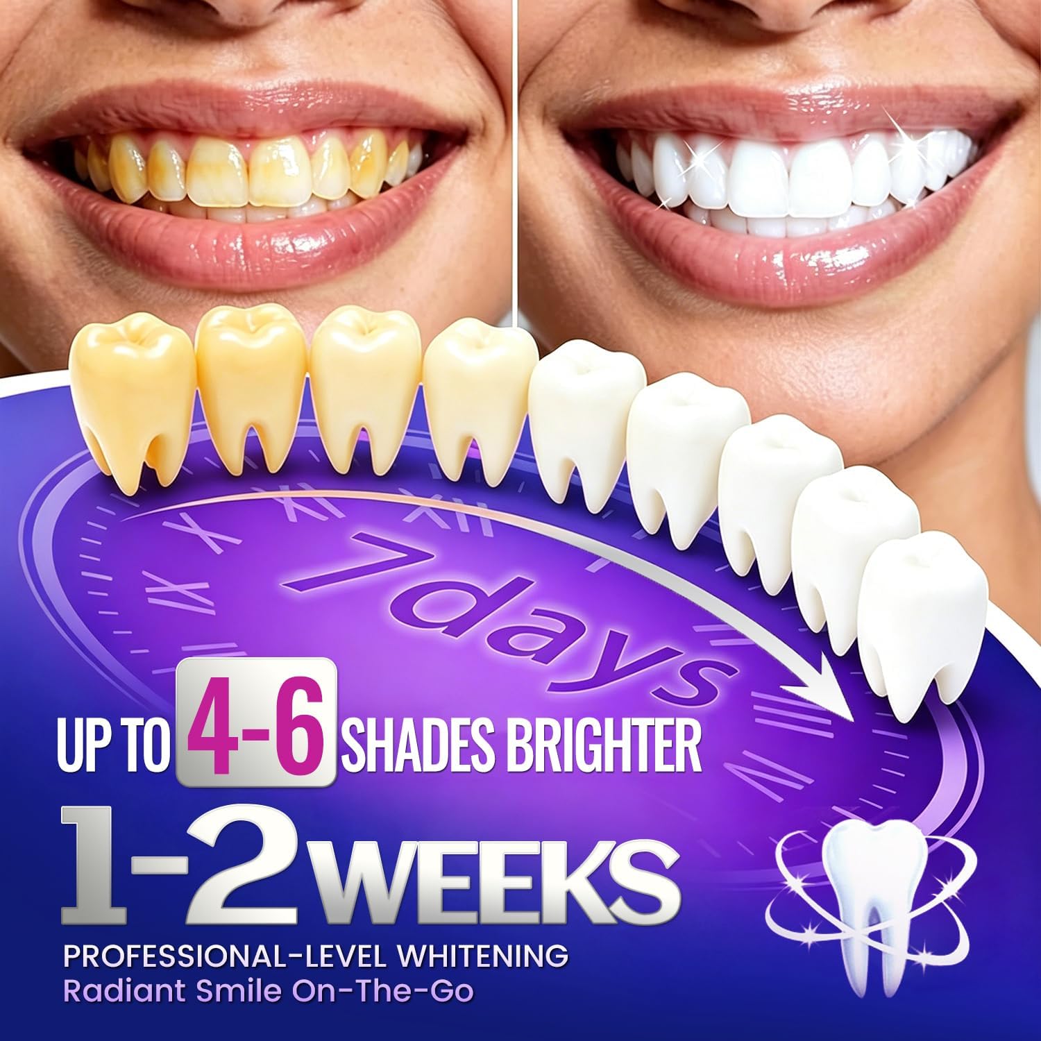 7 пар полосок для отбеливания  – обзор и цена Teeth Whitening Retainer