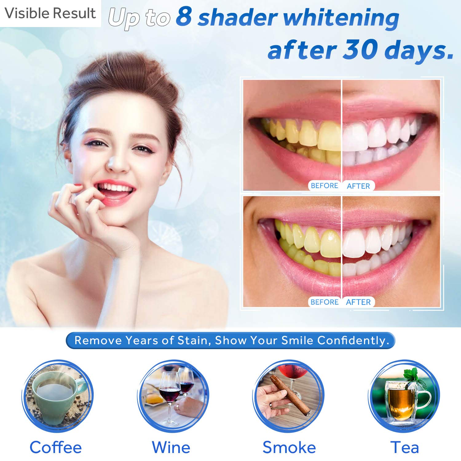 Гель для отбеливания зубов, шп – обзор и цена Teeth Whitening With Trays