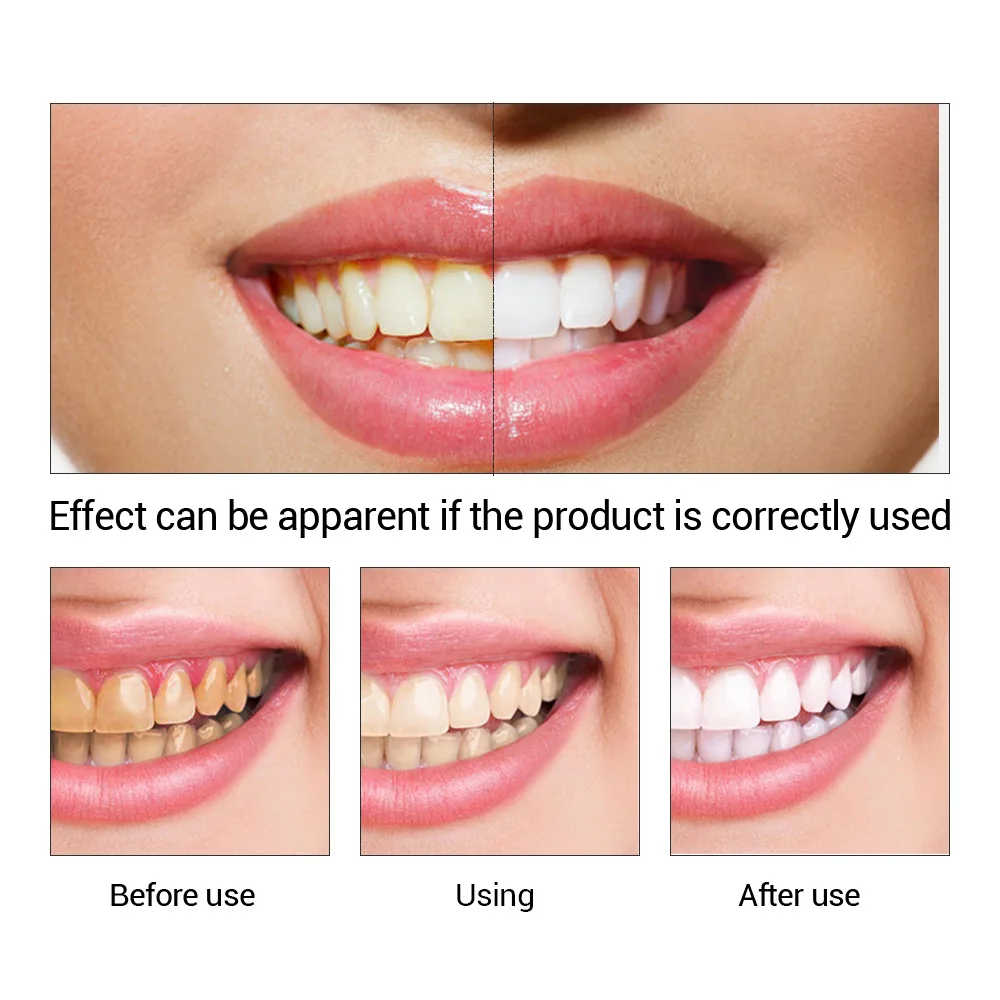 FTEENPLY отбеливание зубов быс – обзор и цена Teeth Whitening Paste