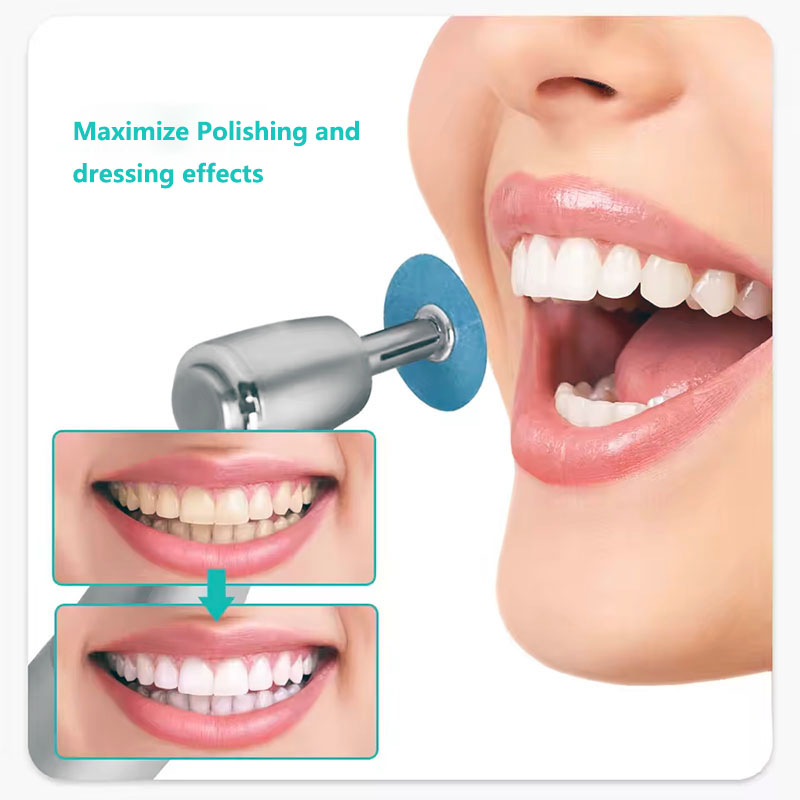 40 шт., стоматологические поли – обзор и цена Teeth Whitening Uk