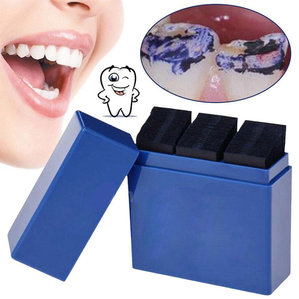 300 листов артикуляционной бум – обзор и цена Teeth Whitening Uk