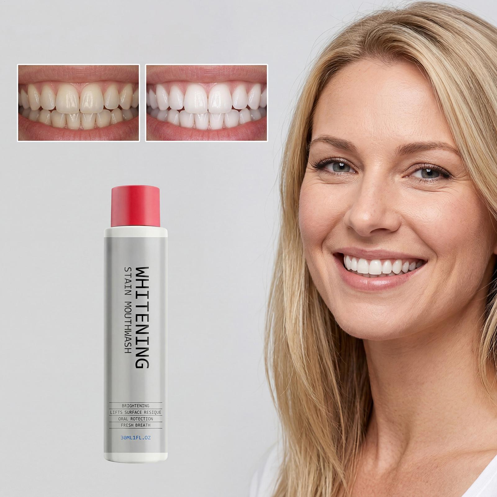 30 мл отбеливающего ополаскива – обзор и цена Teeth Whitening Mouthwash