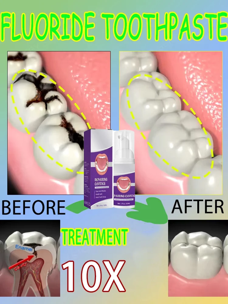 Горячие продажи. Самые продава – обзор и цена Teeth Whitening Mouthwash