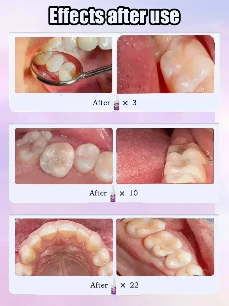Горячие продажи. Самые продава – обзор и цена Teeth Whitening Mouthwash
