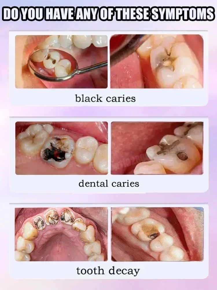 Горячие продажи. Самые продава – обзор и цена Teeth Whitening Mouthwash