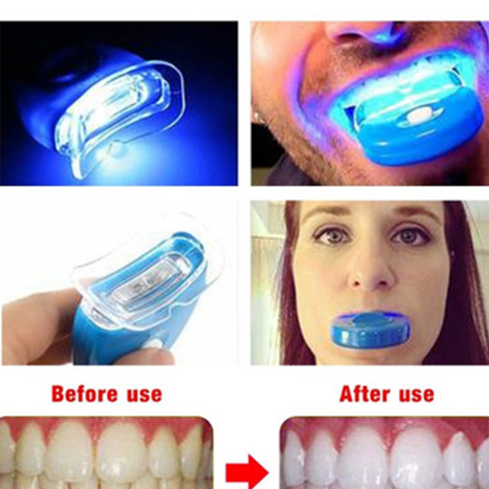 Новый синий светодиод отбелива – обзор и цена Teeth Whitening Uv Kit