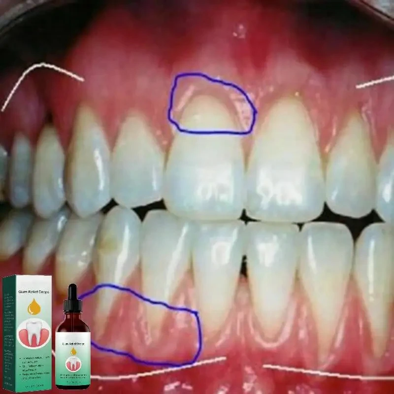 Капли для ремонта десен, снима – обзор и цена Teeth Whitening Paste
